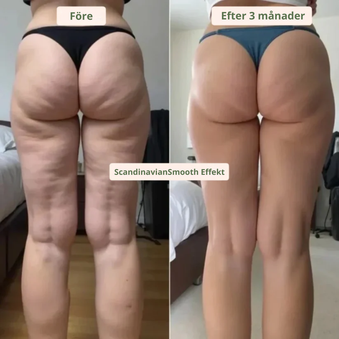 Scandinavian Smooth - Anticellulit Massageolja